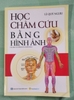 Học Châm Cứu Bằng Hình Ảnh
