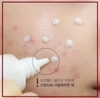tinh-chat-tri-mun-innisfree-bija-trouble-spot-essence