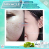 Kem dưỡng trắng da làm mờ nám tàn nhang Miracle White Care Thái Lan