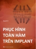 Phục hình toàn hàm trên Implant