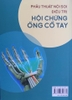 Phẫu thuật nội soi điều trị Hội chứng ống cổ tay