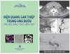 Sách - Điện quang can thiệp trong ung bướu tài liệu đào tạo liên tục