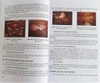 Sách Lạc nội mạc tử cung