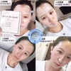 Mặt Nạ Derm all Matrix