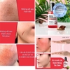Tinh Chất Ốc Sên Đen Trị Sẹo Lõm - Sẹo Mụn Some By Mi Snail Truecica Miracle Repair Serum 50ml