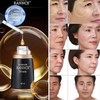 Tinh Chất Dưỡng Trắng, Đặc Trị Nám Dongsung Rannce Serum 45ml