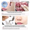 Tinh Chất Tái Tạo Da Red Peel Tingle Serum 35ml