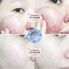 Sample Red Peel Tingle Serum - Peel Da Không Bong Tróc