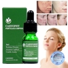 Serum Trị Mụn Caryophy 10ml