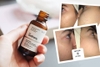 Sữa dưỡng chống lão hoá cao, không di ứng The Ordinary Granactive Retinoid 2% Emulsion 30ml