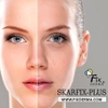 00-Kem Dưỡng Fix Derma Skarfix - TX Cream 15g