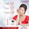 Kem Dưỡng Angle's Liquid Tranexamic Acid Mela Cream 50ml