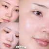 Mặt Nạ Sur.Medic+ Super Glutathione 100Tm Bright Mask