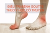 Bệnh gout theo y học cổ truyền là gì? Cách điều trị bệnh gout theo y học cổ truyền