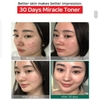 HP25 AHA BHA Toner Nước Hoa Hồng 150ml