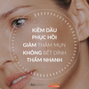 EKSEPTION - Serum NIACIN - Tinh chất dưỡng ẩm, kiểm soát dầu, mờ thâm mụn, hỗ trợ giảm mụn & cải thiện nếp nhăn (75ml)