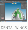 Máy scan 3D nha khoa Runyes Scanner