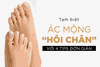 TẠM BIỆT ÁC MỘNG “HÔI CHÂN” VỚI 4 TIPS ĐƠN GIẢN