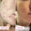 MẶT NẠ ĐẤT SÉT - SAND & SKY AUSTRALIAN PINK CLAY POREFINING MASK