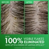 DẦU GỘI GIẢM GÀU - DERCOS SELENIUM SULFIDE ANTI DANDRUFF SHAMPOO, ELIMINATES FLAKES & FIGHTS RECURRING DANDRUFF & ITCHY SCALP, COLOR SAFE SHAMPOO, 2X LESS BREAKAGE, SUITABLE FOR ALL HAIR TYPES