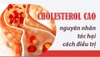 240 Viên uống men gạo đỏ bổ tim giảm mỡ máu xấu (cholesterol) Weider Red Yeast Rice Plus 1200mg chuẩn Mỹ