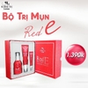 bo-tri-mun-vitamin-e-do-huong-thi-red-e-solution