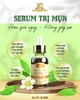 combo-face-giam-mun-mo-tham-serum-cao-nghe-sua-rua-mat