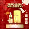 serum-mun