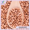 1KG ĐẬU CÚC PINTO