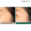 Miếng dán mụn Some By Mi Acnes Clear Patch