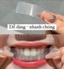 Set miếng dán trắng răng Crest 3D Whitestrips Professional Transformation Monthly Brightener