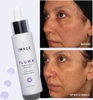 Serum Trị Nám Trắng Da Image Iluma Intense Facial Illuminator 30ml