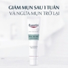 Combo Eucerin tinh chất giảm mụn Pro Acne A.I Treatment 40ml & nước tẩy trang cho da nhờn mụn 200ml
