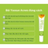 Kem Ngừa Mụn Yoosun Acnes Tuýp 15g - Sạch Mụn, Thâm Từ Thảo Dược, Cho Da Dầu, Khô Đầu Đen, Mụn Mủ Cho Nam Nữ