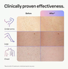 Máy Triệt Lông Laser Cao Cấp Braun Skin i-Expert IPL 7 PL7243 / PL5267 / PL5257 Chính Hãng