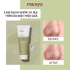 Sữa rửa mặt tạo bọt MA:NYO Pore Cleansing Soda Foam 150ml