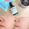 SRM sủi bọt SOME BYE MI Bye Bye Blackhead GreenTea 120ml