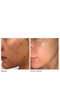 Tẩy tế bào chết Peel da sinh học Dr Dennis Gross Alpha Beta Extra Strength Daily hộp 3 miếng
