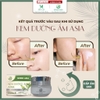 KEM DƯỠNG ẨM ASIA MOISTURE CREAM