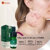 Serum Lymina Acne giảm mụn, mờ thâm, hỗ trợ se khít lỗ chân lông