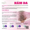 Những điều cần nhớ khi trị nám