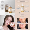 Tinh Chất Skin1004 Rau Má Giảm Mụn & Phục Hồi Da 55ml Madagascar Centella Ampoule