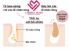 Miếng dán lột mụn Kose hộp 10 miếng