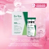 ex-tox-botox-100-ul-botox-thon-gon-ham-xoa-nhan-duoi-mat-tran-va-tiem-tri-hoi-na