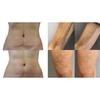 profhilo-figura-body-cream-kem-tai-tao-va-lam-san-chac-da-body