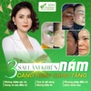 3 sai lầm khiến nám ngày càng tăng ‼