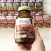 vien-uong-nattokinase-premium-4000fu-noguchi-chong-va-ho-tro-dieu-tri-tai-bien
