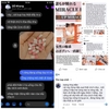 vien-uong-no-nguc-no-mong-nhat-ban-b-up-miracle-60-vien