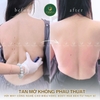 ✨ LIỆU TRÌNH TIÊU MỠ LƯỜN SAU – THON GỌN ĐƯỜNG CONG TỰ NHIÊN ✨