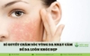 Bí quyết chăm sóc vùng da nhạy cảm để da luôn khỏe đẹp